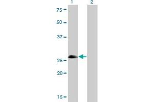 Western Blot analysis of ASCL1 expression in transfected 293T cell line by ASCL1 monoclonal antibody (M01), clone 7E11. (ASCL1 抗体  (AA 137-236))