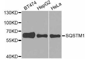 Western blot analysis of extracts of various cell lines, using SQSTM1 antibody. (SQSTM1 抗体)