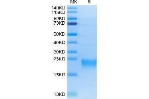 SDS-PAGE (SDS) image for Tumor Necrosis Factor Receptor Superfamily, Member 13C (TNFRSF13C) protein (His-Avi Tag,Biotin) (ABIN7273915)