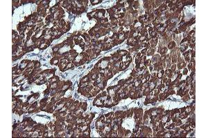 Immunohistochemistry (IHC) image for anti-Acetyl-CoA Acyltransferase 2 (ACAA2) antibody (ABIN1495723) (ACAA2 抗体)