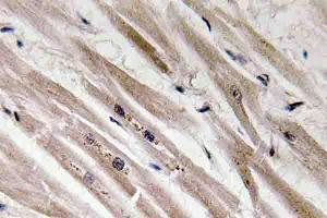Immunohistochemistry (IHC) analyzes of Caspase12 antibody in paraffin-embedded human heart tissue. (Caspase 12 抗体)