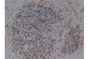 Immunohistochemistry (IHC) image for anti-Alanine Aminotransferase (ALT) (AA 581-738) antibody (ABIN7433093)