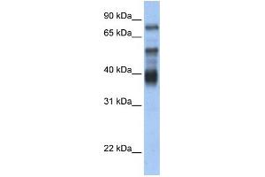 WB Suggested Anti-ZNF395 Antibody Titration:  0. (ZNF395 抗体  (Middle Region))