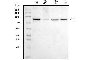 Western blot analysis of RRM1 using anti-RRM1 antibody (ABIN7599920).