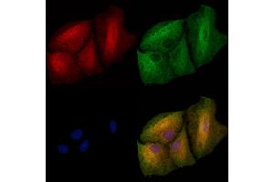 ABIN6262955 and ABIN6272923 staining  cells by IF/ICC.