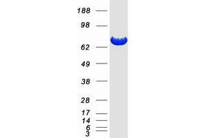Western Blotting (WB) image for NAD Synthetase 1 (NADSYN1) protein (Myc-DYKDDDDK Tag) (ABIN2726780)