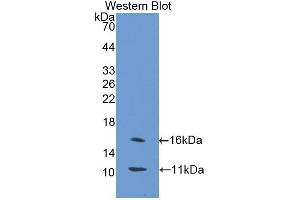 Western blot analysis of the recombinant protein. (SLC30A8 抗体  (AA 1-80))