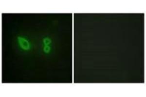 Immunofluorescence analysis of HeLa cells, using Actin α-2/3 antibody. (ACTN3 抗体  (N-Term))