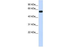 WB Suggested Anti-HIC2 Antibody Titration:  0.