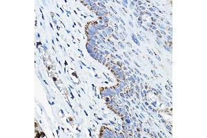 Immunohistochemistry of paraffin-embedded human esophageal using OGDHL Rabbit pAb (ABIN7269135) at dilution of 1:200 (40x lens). (OGDHL 抗体  (AA 1-110))