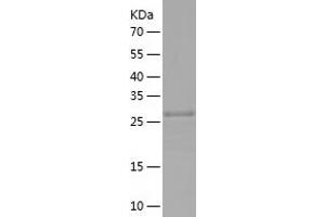 Western Blotting (WB) image for Zinc Finger CCCH-Type Containing 12A (ZC3H12A) (AA 234-503) protein (His tag) (ABIN7125769)