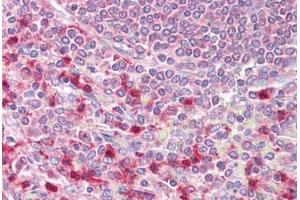 Immunohistochemistry (IHC) image for anti-Eukaryotic Translation Initiation Factor 4B (EIF4B) (AA 570-630) antibody (ABIN960160)