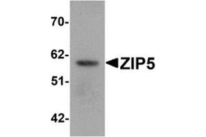 Western blot analysis of ZIP5 in human spleen tissue lysate with ZIP5 antibody at 1 μg/ml. (SLC39A5 抗体  (Center))