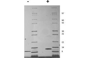 SDS-PAGE of Mouse Interleukin-15 Recombinant Protein SDS-PAGE of Mouse Interleukin-15 Recombinant Protein. (IL-15 蛋白)