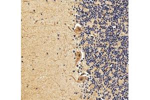 anti-Exosome Component 3 (EXOSC3) (AA 64-275) antibody