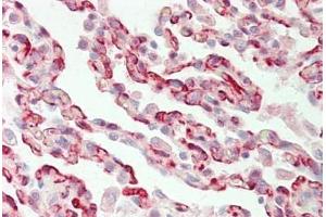 anti-F-Box and Leucine-Rich Repeat Protein 5 (FBXL5) (AA 510-691) antibody