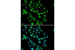 Immunofluorescence analysis of U2OS cells using STAMBP antibody. (STAMBP 抗体  (AA 100-270))