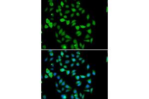 Immunofluorescence analysis of U2OS cells using STAMBP antibody. (STAMBP 抗体  (AA 100-270))