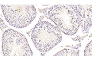 Detection of tPA in Mouse Testis Tissue using Polyclonal Antibody to Tissue Plasminogen Activator (tPA) (PLAT 抗体  (AA 359-532))