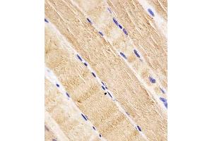 (ABIN652609 and ABIN2842407) staining RAB7 in human skeletal muscle tissue sections by Immunohistochemistry (IHC-P - paraformaldehyde-fixed, paraffin-embedded sections).