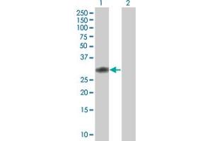 Western Blot analysis of CCDC88B expression in transfected 293T cell line by CCDC88B MaxPab polyclonal antibody. (CCDC88B 抗体  (AA 1-223))
