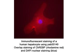 Image no. 1 for anti-MLX Interacting Protein-Like (MLXIPL) (AA 800-852), (C-Term), (Isoform 1) antibody (ABIN363458)