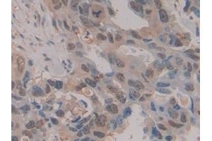 Immunohistochemistry (IHC) image for anti-Heat Shock 70kDa Protein 1A (HSPA1A) (AA 285-641) antibody (ABIN7443083)