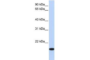 WB Suggested Anti-EVX2 Antibody Titration: 0. (EVX2 抗体  (N-Term))