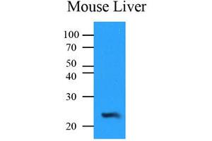Western Blotting (WB) image for anti-NQO2 (NQO2) antibody (ABIN567621) (NQO2 抗体)