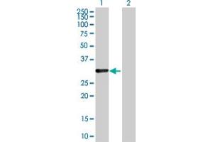 Western Blot analysis of CDCA8 expression in transfected 293T cell line by CDCA8 MaxPab polyclonal antibody. (CDCA8 抗体  (AA 1-280))