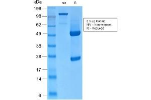 SDS-PAGE Analysis of Purified CK HMW Rabbit Recombinant Monoclonal Antibody (KRTH/2147R). (Recombinant Cytokeratin 2 抗体)