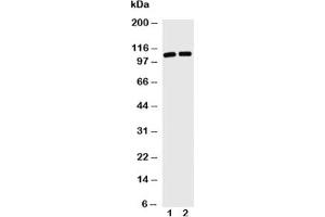 Western blot with TRIF antibody and Lane 1: Jurkat;  2: HL-60 cell lysate (TICAM1 抗体  (C-Term))