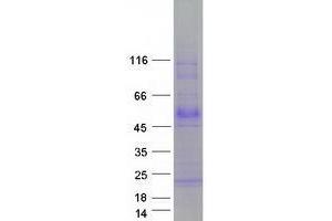 Western Blotting (WB) image for Transmembrane Protein with EGF-Like and Two Follistatin-Like Domains 1 (TMEFF1) protein (Myc-DYKDDDDK Tag) (ABIN2733995)