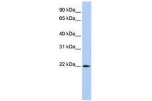 Image no. 1 for anti-Deoxyribonuclease II beta (DNASE2B) (C-Term) antibody (ABIN6743113) (DNASE2B 抗体  (C-Term))