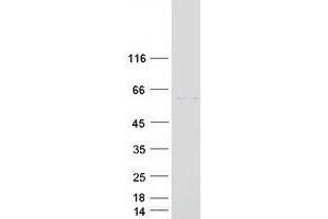 Western Blotting (WB) image for RAR-Related Orphan Receptor C (RORC) (Transcript Variant 1) protein (Myc-DYKDDDDK Tag) (ABIN2731080)