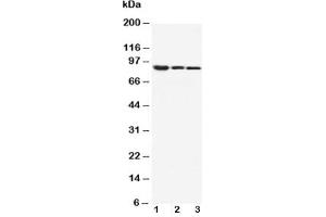 Western blot testing of beta Catenin antibody and Lane 1:  MM453;  2: MCF-7;  3: HeLa cell lysate (beta Catenin 抗体  (AA 764-781))