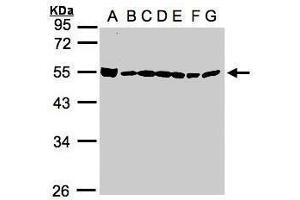 WB Image Sample(30μg whole cell lysate) A: 293T B: A431 , C: H1299 D: HeLa S3 , E: Hep G2 , F: MOLT4 , G: Raji , 10% SDS PAGE antibody diluted at 1:1000 (BAT1 抗体  (Center))