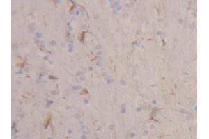 IHC-P analysis of Rat Cerebrum Tissue, with DAB staining. (Keratin 2 抗体  (AA 368-507))
