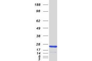 Western Blotting (WB) image for Protein tyrosine Phosphatase Type IVA, Member 2 (PTP4A2) (Transcript Variant 1) protein (Myc-DYKDDDDK Tag) (ABIN2730095)