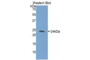 Western Blotting (WB) image for anti-Glutathione Synthetase (GSS) (AA 270-474) antibody (ABIN1859085) (Glutathione Synthetase 抗体  (AA 270-474))