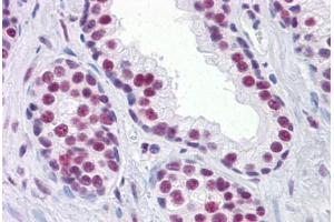 Human Prostate: Formalin-Fixed, Paraffin-Embedded (FFPE) (RUNX2 抗体  (AA 251-351))