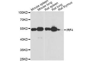 Western blot analysis of extracts of various cell lines, using IRF4 antibody. (IRF4 抗体)