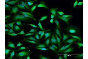 Immunofluorescence of purified MaxPab antibody to IFIT2 on HeLa cell. (IFIT2 抗体  (AA 1-484))