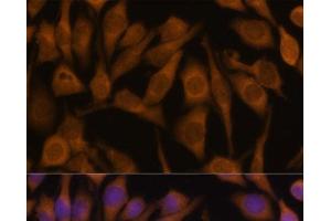 Immunofluorescence analysis of HeLa cells using UBQLN2 Polyclonal Antibody at dilution of 1:100 (40x lens). (Ubiquilin 2 抗体)