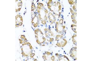 Immunohistochemistry of paraffin-embedded human stomach using ST6G antibody (ABIN6130083, ABIN6148536, ABIN6148538 and ABIN6221427) at dilution of 1:100 (40x lens). (ST6GAL1 抗体  (AA 27-200))