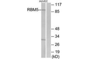 Western blot analysis of extracts from HuvEc cells, using RBM5 Antibody. (RBM5 抗体  (AA 226-275))