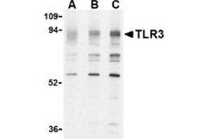 Western blot analysis of TLR3 in K562 cell lysate with this product at (A) 0. (TLR3 抗体  (N-Term))
