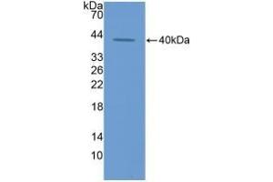 Detection of Recombinant ECF, Rat using Polyclonal Antibody to Eosinophil Chemotactic Factor (ECF) (ECF 抗体  (AA 24-97))