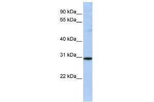 RAB26 antibody used at 1 ug/ml to detect target protein. (RAB26 抗体  (N-Term))