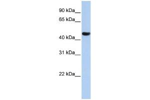 WB Suggested Anti-ZNF286A Antibody Titration:  0. (ZNF286A 抗体  (N-Term))